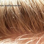 What do head lice look like