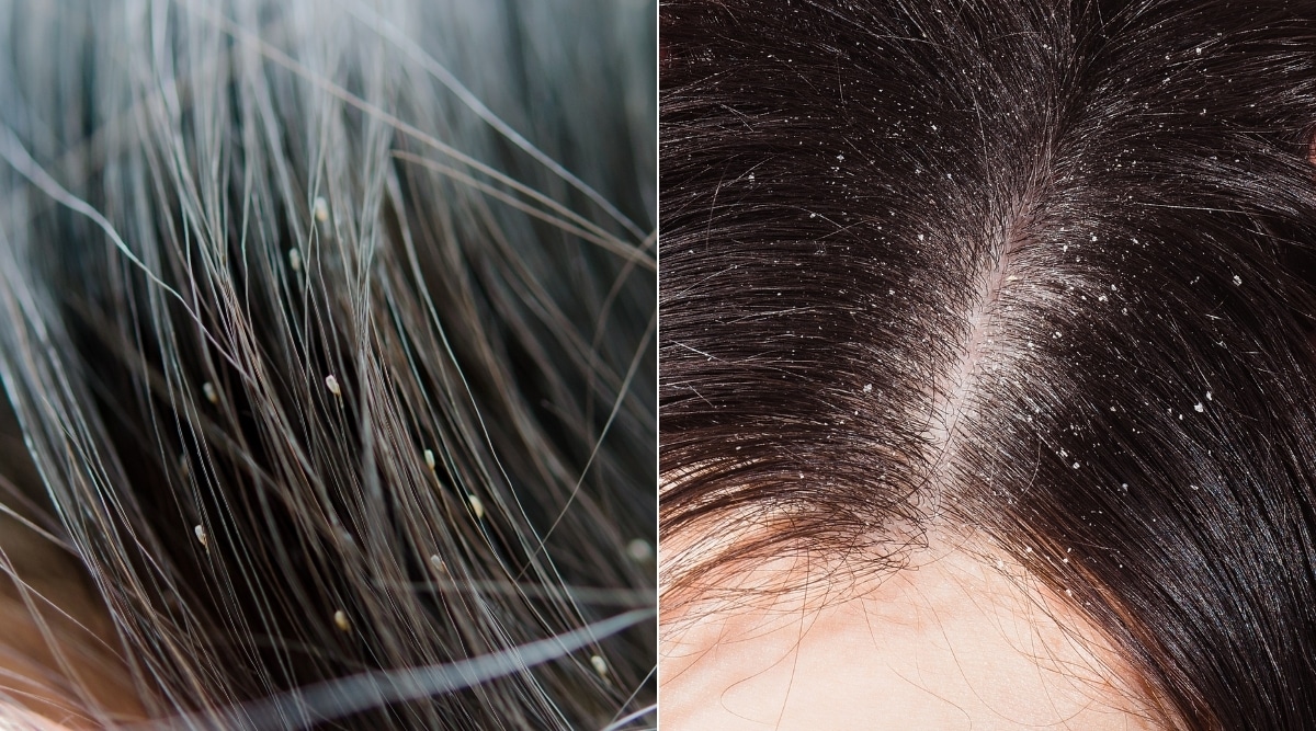 9. How to Remove Head Lice Eggs from Blonde Hair - wide 2